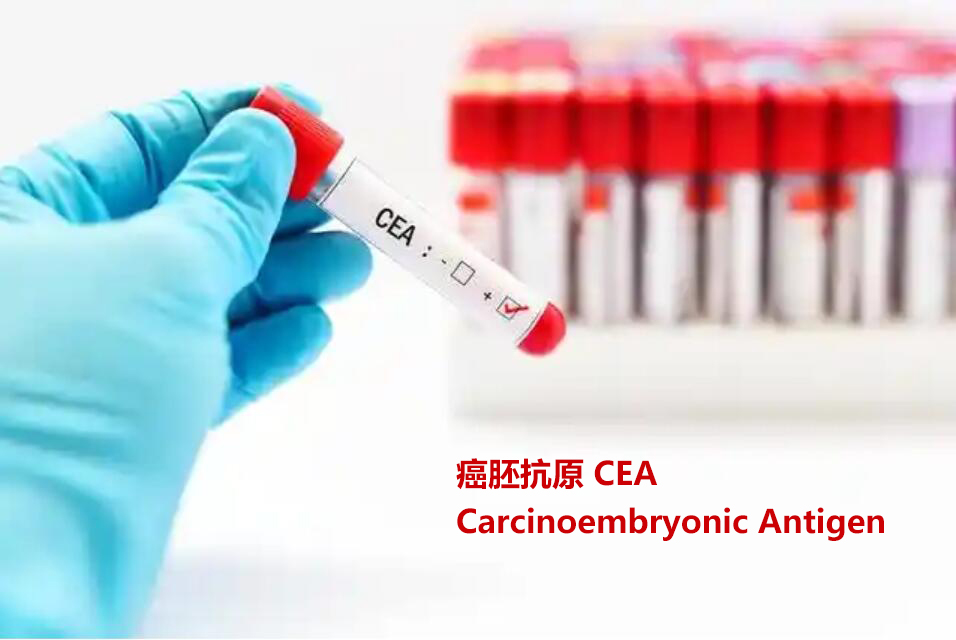 癌胚抗原CEA检测方法及参考值