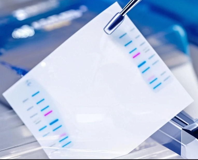 Western Blot 实验流程指南