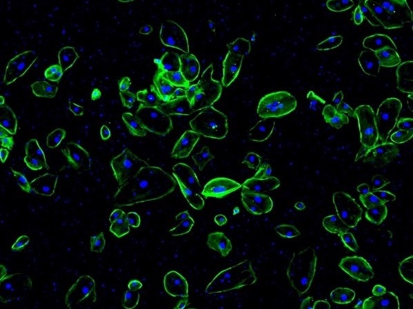 细胞膜染色效果 细胞膜染色效果