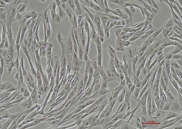 人滑膜肉瘤细胞SW982