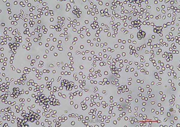 人B淋巴细胞母细胞系LCL 721.221