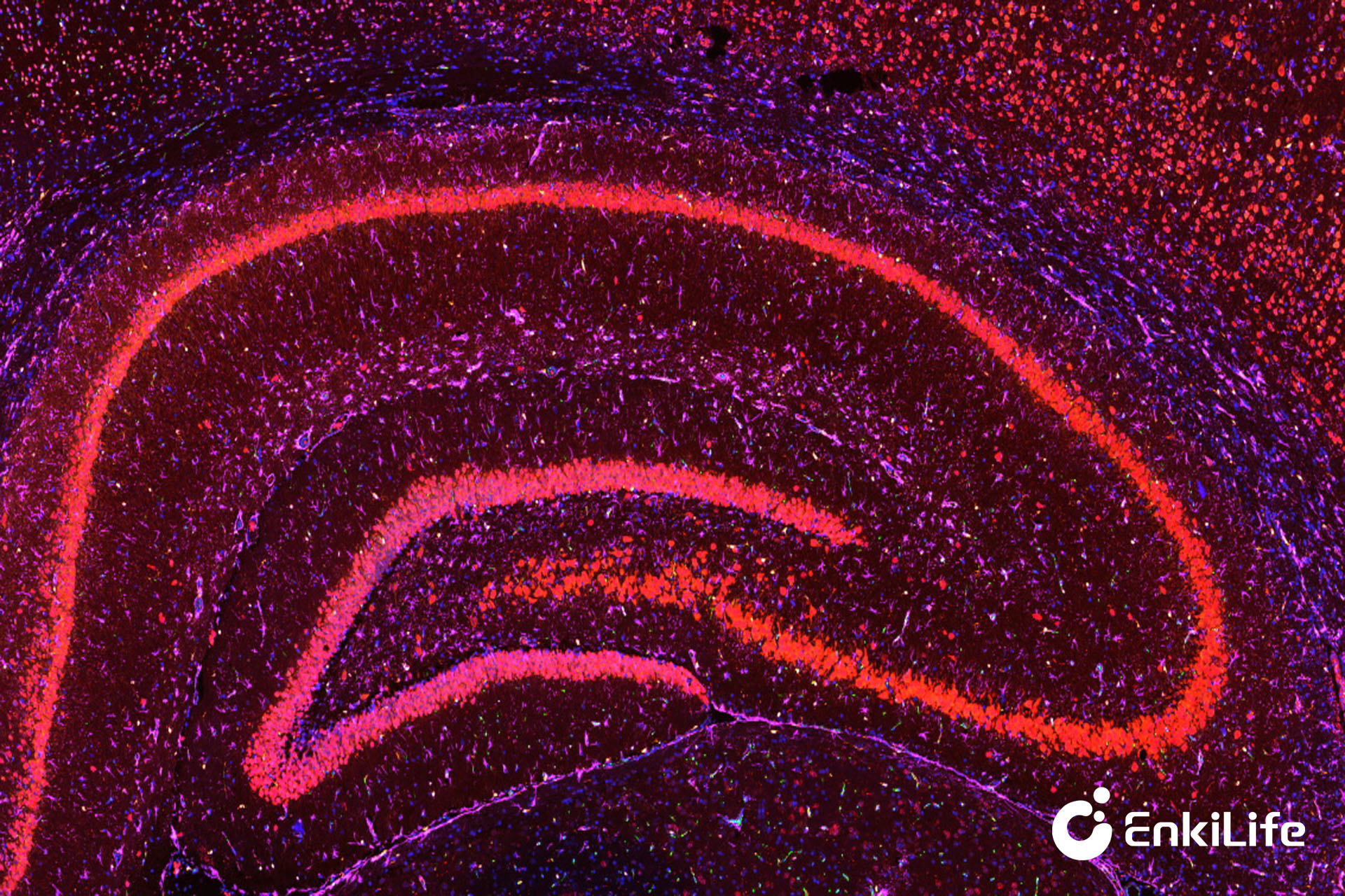 深度解析：多重免疫荧光（TSA）与IHC/IF的核心差异