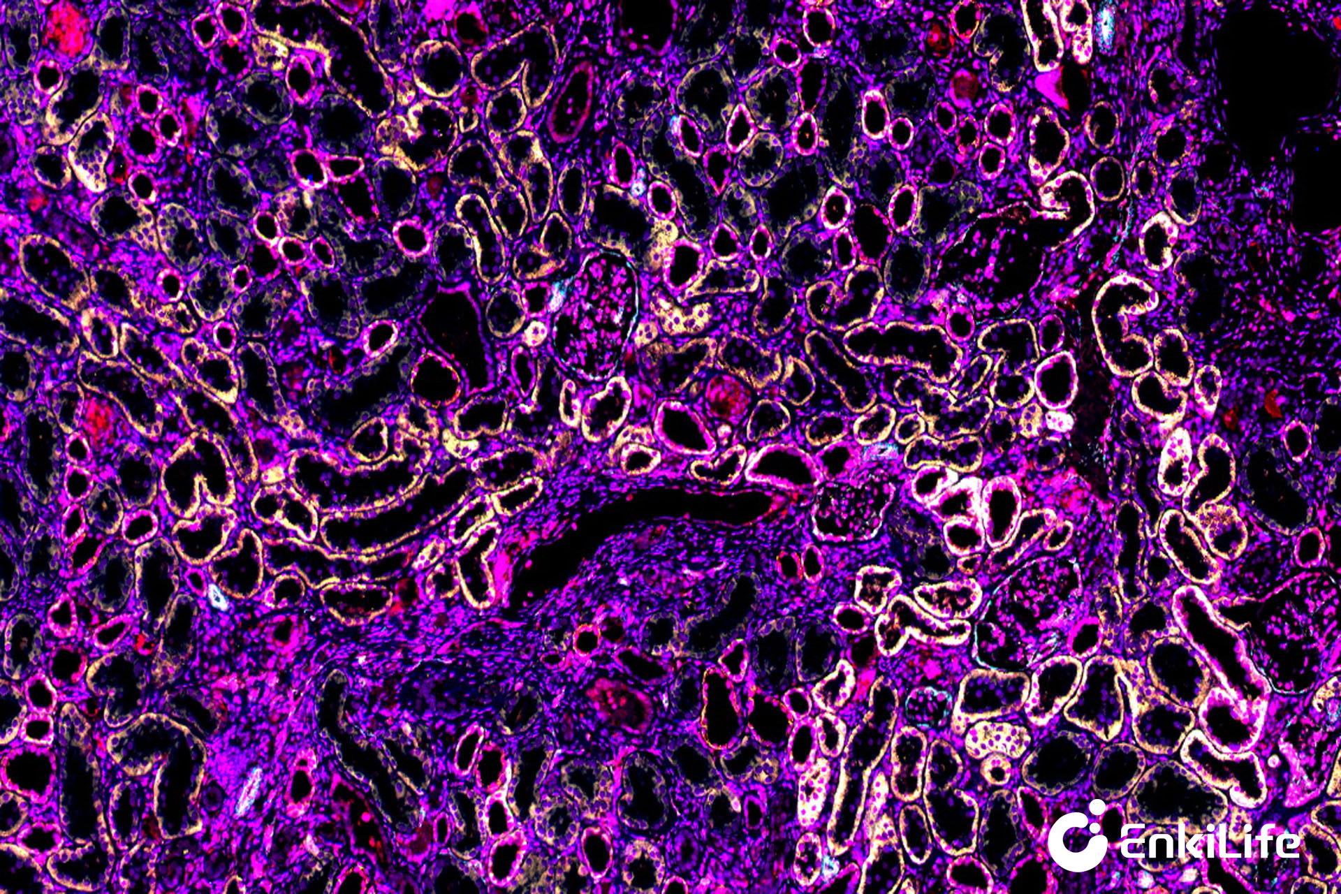 mIHC多重荧光免疫组化TSA试剂盒