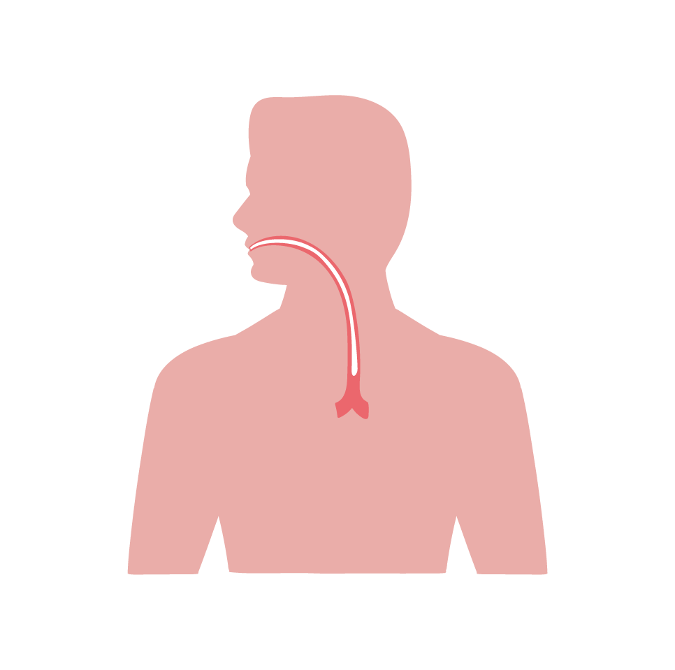 食管癌（Esophageal Cancer）