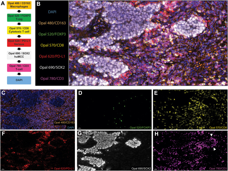 文献分享：多重免疫荧光用于MCC肿瘤微环境研究
