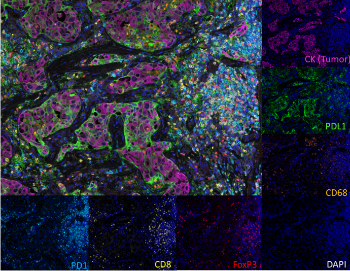 文献分享：SITC关于多色免疫组织化学与免疫荧光染色及验证的最佳实践