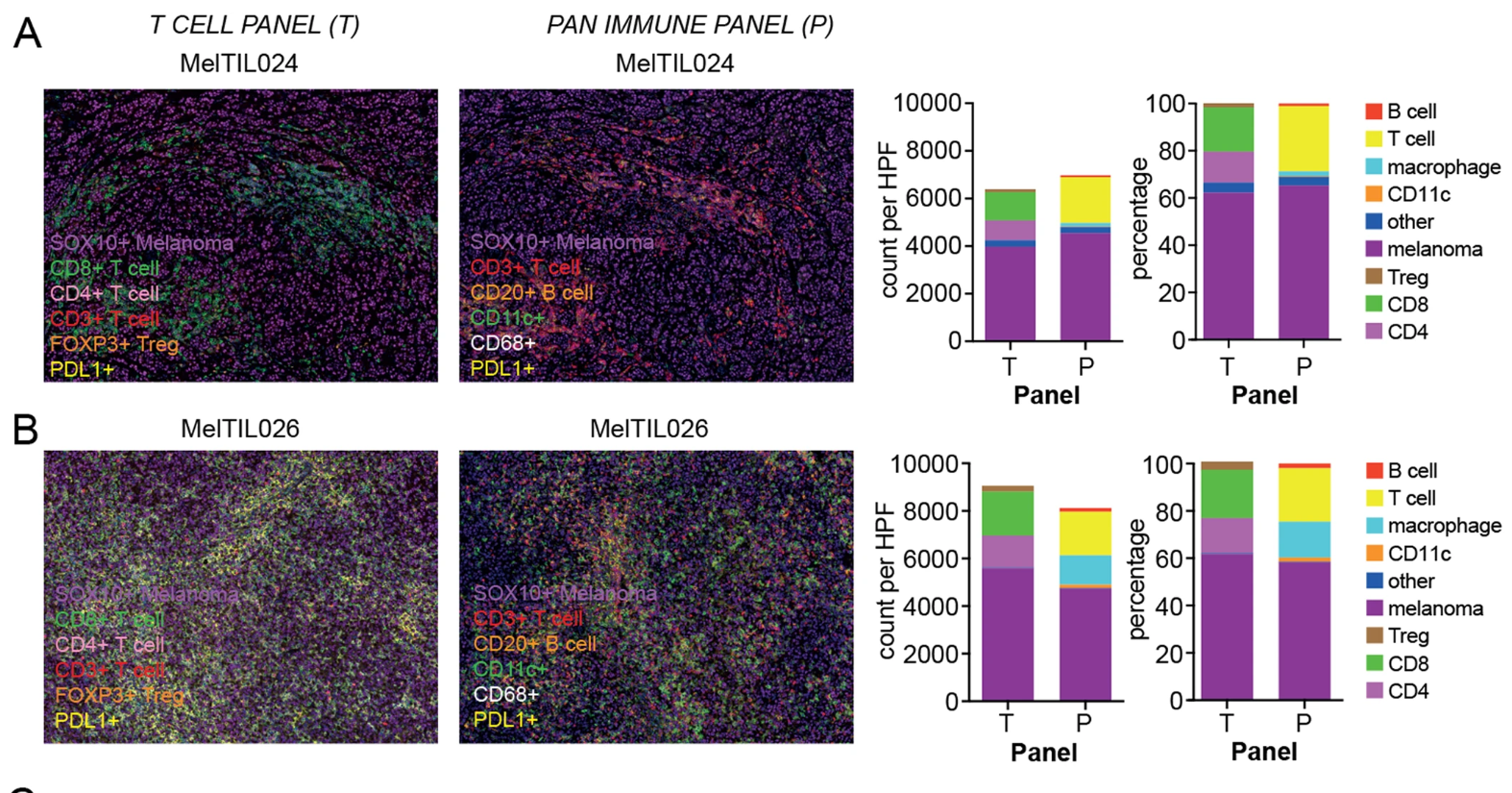 文献分享：多重免疫组织化学准确定义转移性黑色素瘤的肿瘤微环境