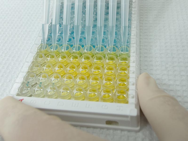 ELISA实验结果判读指南