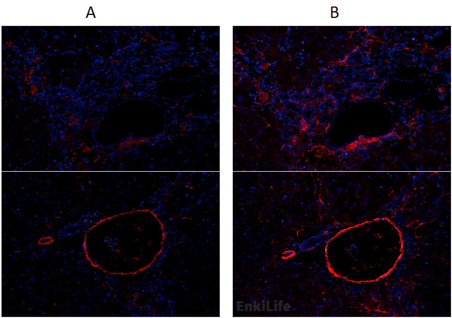 大鼠肝癌组织免疫荧光图像