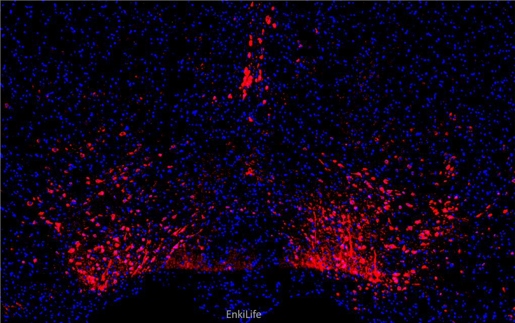 小鼠脑组织免疫荧光图像