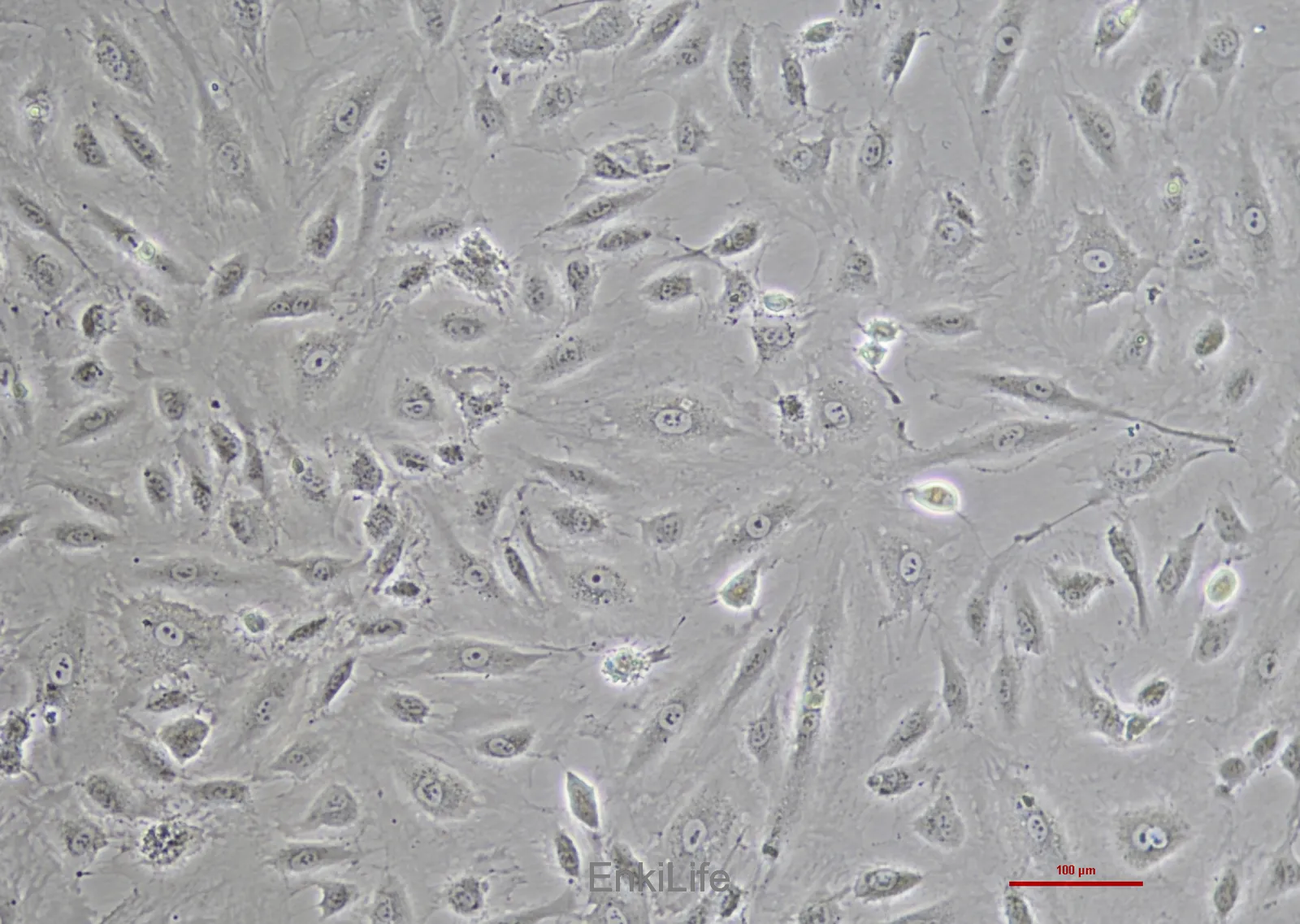 人脐静脉血管内皮细胞 HUVEC