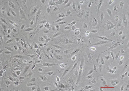 人脐静脉血管内皮细胞 HUVEC