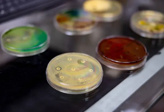 细胞培养常见问题