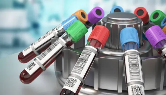 血清血浆样本处理